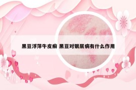 黑豆浮萍牛皮癣 黑豆对银屑病有什么作用