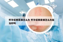 怀孕后银屑病怎么办 怀孕后银屑病怎么办能治好吗