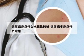 银屑病吃点什么水果比较好 银屑病多吃点什么水果