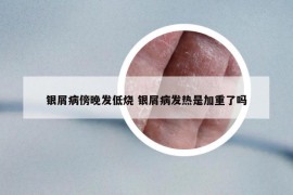 银屑病傍晚发低烧 银屑病发热是加重了吗