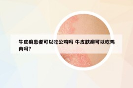 牛皮癣患者可以吃公鸡吗 牛皮肤癣可以吃鸡肉吗?