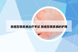 脓疱型银屑病治疗考试 脓疱型银屑病的护理