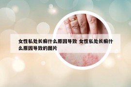 女性私处长癣什么原因导致 女性私处长癣什么原因导致的图片