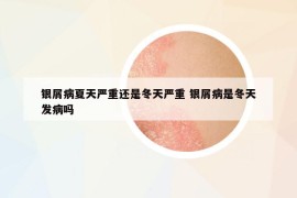 银屑病夏天严重还是冬天严重 银屑病是冬天发病吗