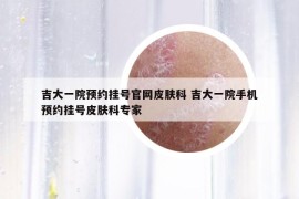 吉大一院预约挂号官网皮肤科 吉大一院手机预约挂号皮肤科专家