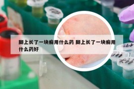 脚上长了一块癣用什么药 脚上长了一块癣用什么药好