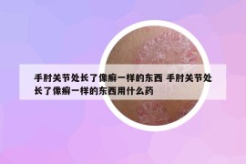 手肘关节处长了像癣一样的东西 手肘关节处长了像癣一样的东西用什么药