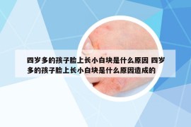 四岁多的孩子脸上长小白块是什么原因 四岁多的孩子脸上长小白块是什么原因造成的