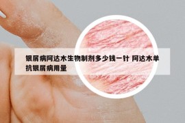 银屑病阿达木生物制剂多少钱一针 阿达木单抗银屑病用量