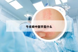 牛皮癣中医学是什么