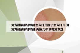 复方醋酸氟轻松酊怎么打开瓶子怎么打开 用复方醋酸氟轻松酊,两瓶几年没有复发过