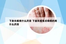 下身长癣用什么药膏 下面长癣有点痒痒的用什么药膏