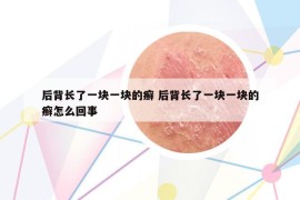 后背长了一块一块的癣 后背长了一块一块的癣怎么回事