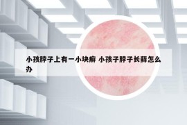 小孩脖子上有一小块癣 小孩子脖子长藓怎么办