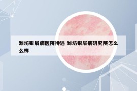 潍坊银屑病医院待遇 潍坊银屑病研究院怎么么样