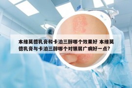 本维莫德乳膏和卡泊三醇哪个效果好 本维莫德乳膏与卡泊三醇哪个对银屑广病好一点?