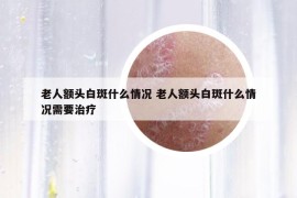 老人额头白斑什么情况 老人额头白斑什么情况需要治疗