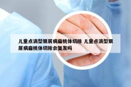 儿童点滴型银屑病扁桃体切除 儿童点滴型银屑病扁桃体切除会复发吗