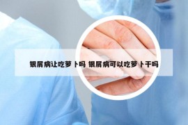 银屑病让吃萝卜吗 银屑病可以吃萝卜干吗