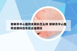 邯郸市中心医院皮肤科怎么样 邯郸市中心医院皮肤科在东区还是西区