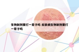 生物制剂要打一辈子吗 皮肤病生物制剂要打一辈子吗