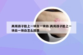 两周孩子脸上一块白一块白 两周孩子脸上一块白一块白怎么回事