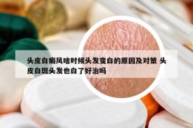 头皮白癜风啥时候头发变白的原因及对策 头皮白斑头发也白了好治吗