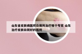 山东省皮肤病医院白癜风治疗哪个专家 山东治疗皮肤白斑好的医院