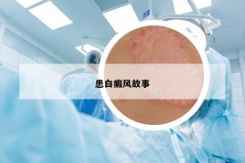 患白癜风故事