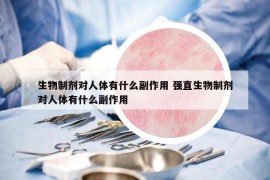 生物制剂对人体有什么副作用 强直生物制剂对人体有什么副作用