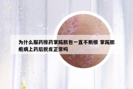 为什么服药擦药掌跖脓包一直不断根 掌跖脓疱病上药后脱皮正常吗