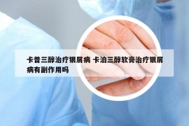 卡普三醇治疗银屑病 卡泊三醇软膏治疗银屑病有副作用吗