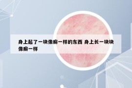 身上起了一块像癣一样的东西 身上长一块块像癣一样