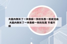 大腿内侧长了一块像癣一样的东西一抓就流血 大腿内侧长了一块像癣一样的东西 不痛不痒