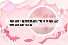 河南省哪个医院银屑病治疗最好 河南省治疗银屑病哪家医院最好