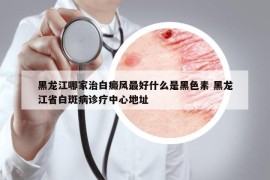 黑龙江哪家治白癜风最好什么是黑色素 黑龙江省白斑病诊疗中心地址