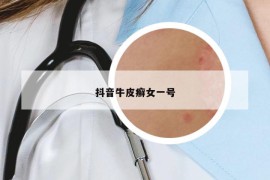 抖音牛皮癣女一号