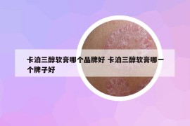 卡泊三醇软膏哪个品牌好 卡泊三醇软膏哪一个牌子好