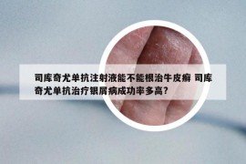 司库奇尤单抗注射液能不能根治牛皮癣 司库奇尤单抗治疗银屑病成功率多高?