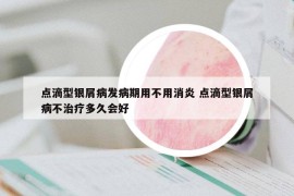 点滴型银屑病发病期用不用消炎 点滴型银屑病不治疗多久会好