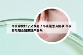 牛皮廨快好了又发起了小点是怎么回事 牛皮廨后期会越来越严重吗