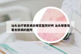 汕头治疗银屑病去哪家医院好啊 汕头哪里有看皮肤病的医院