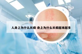 人身上为什么长癣 身上为什么长癣越来越多