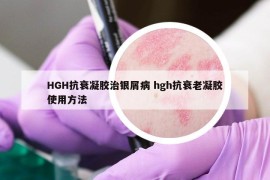 HGH抗衰凝胶治银屑病 hgh抗衰老凝胶使用方法