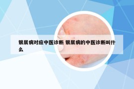 银屑病对应中医诊断 银屑病的中医诊断叫什么