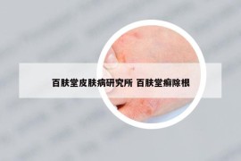 百肤堂皮肤病研究所 百肤堂癣除根