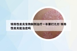 特异性皮炎生物制剂治疗一年要打几针 特异性皮炎能治愈吗