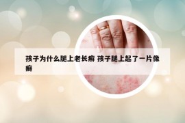 孩子为什么腿上老长癣 孩子腿上起了一片像癣