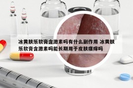 冰黄肤乐软膏含激素吗有什么副作用 冰黄肤乐软膏含激素吗能长期用于皮肤瘙痒吗