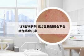 il17生物制剂 il17生物制剂会不会增加癌症几率